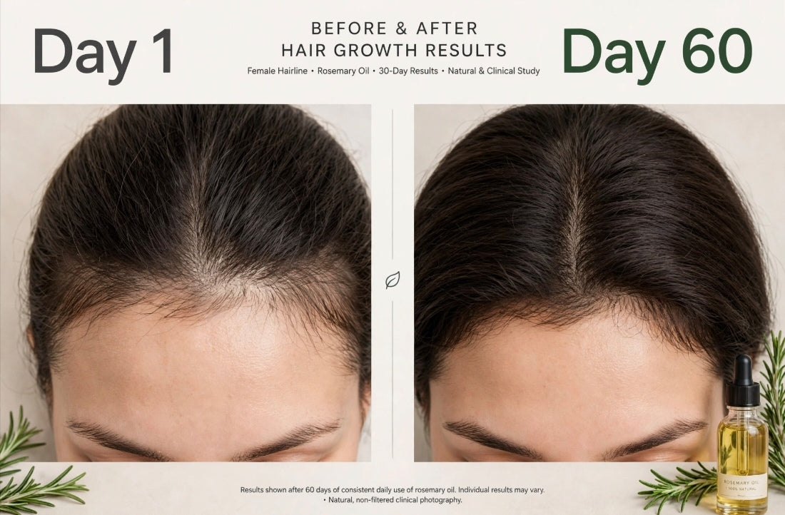 RÒSEVÀ Rosemary Hair & Scalp Oil, 30ml